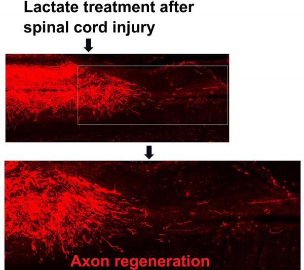 Lactate Treatment